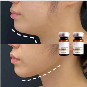 V-line face slimming